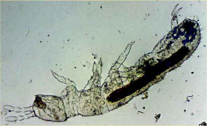 Folsomia quadrioculata.jpg